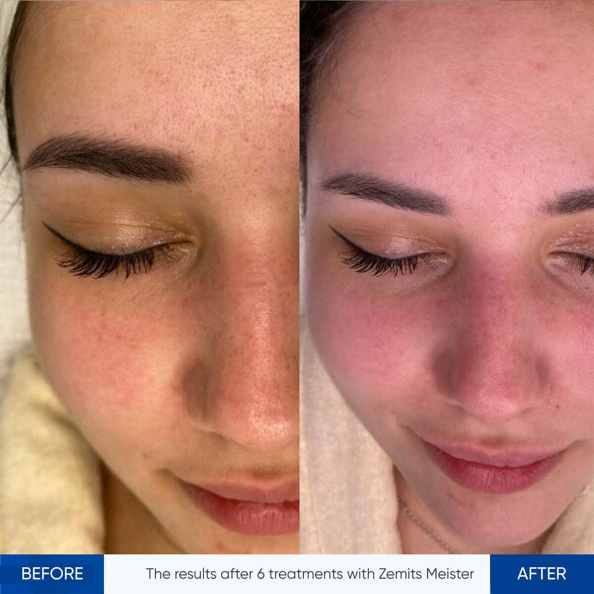 Before After Slide 4