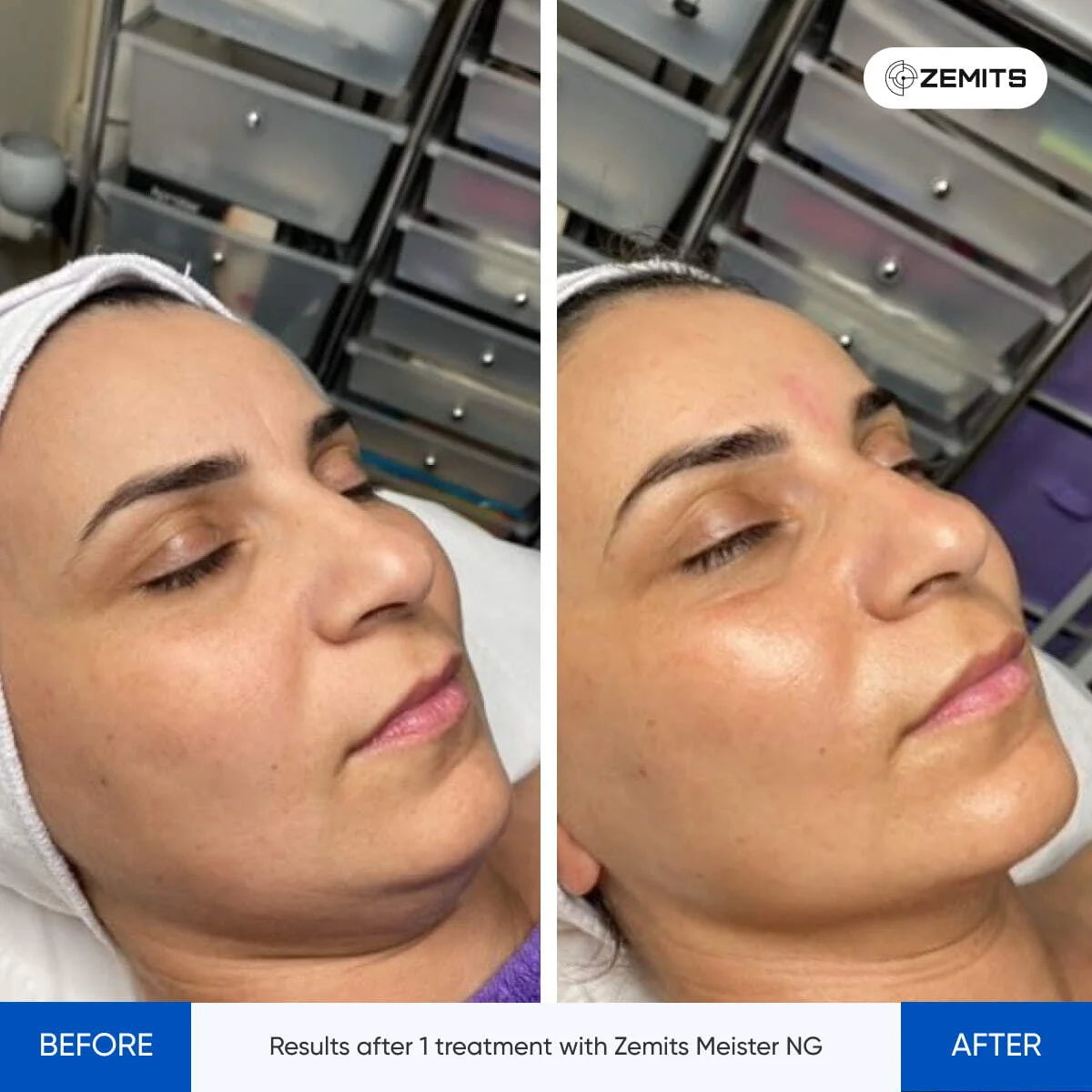 Before After Slide 2