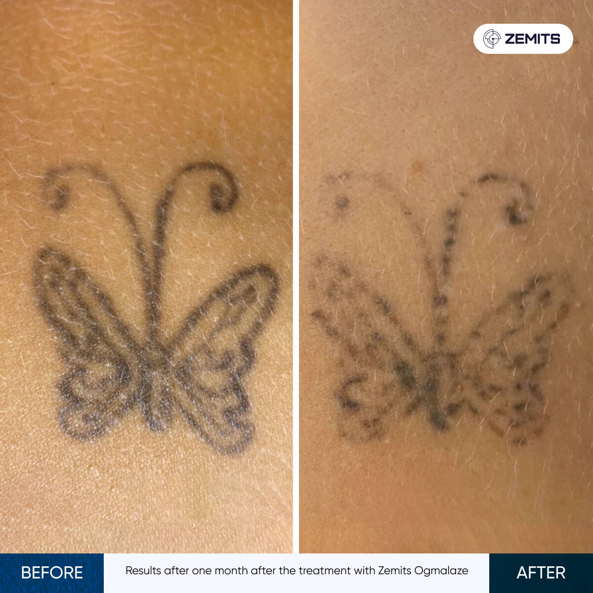 Before After Slide 6