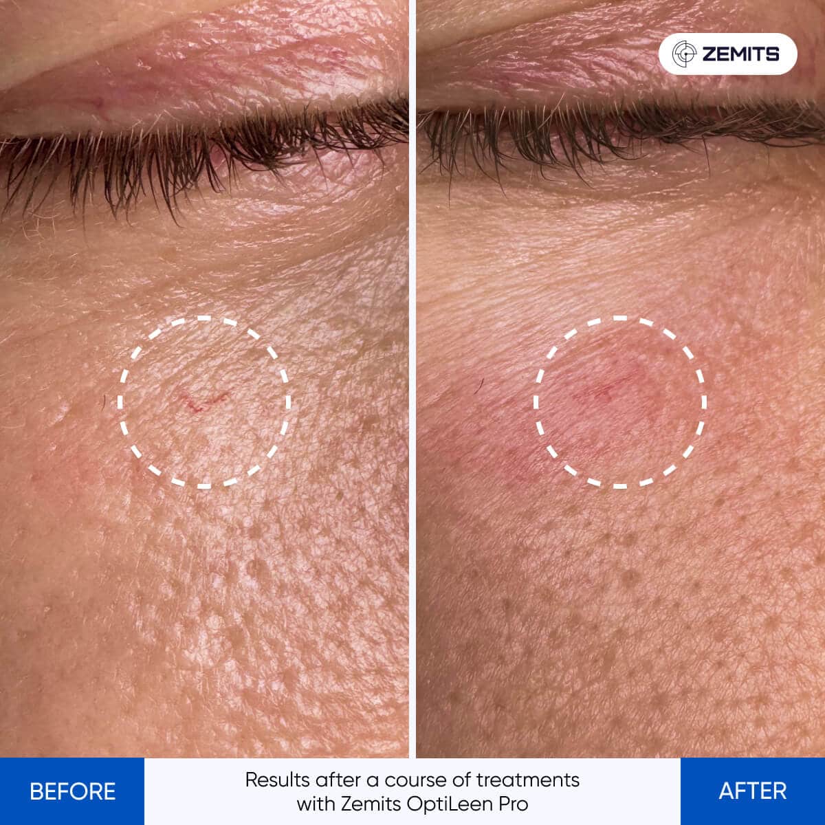 Before After Slide 2