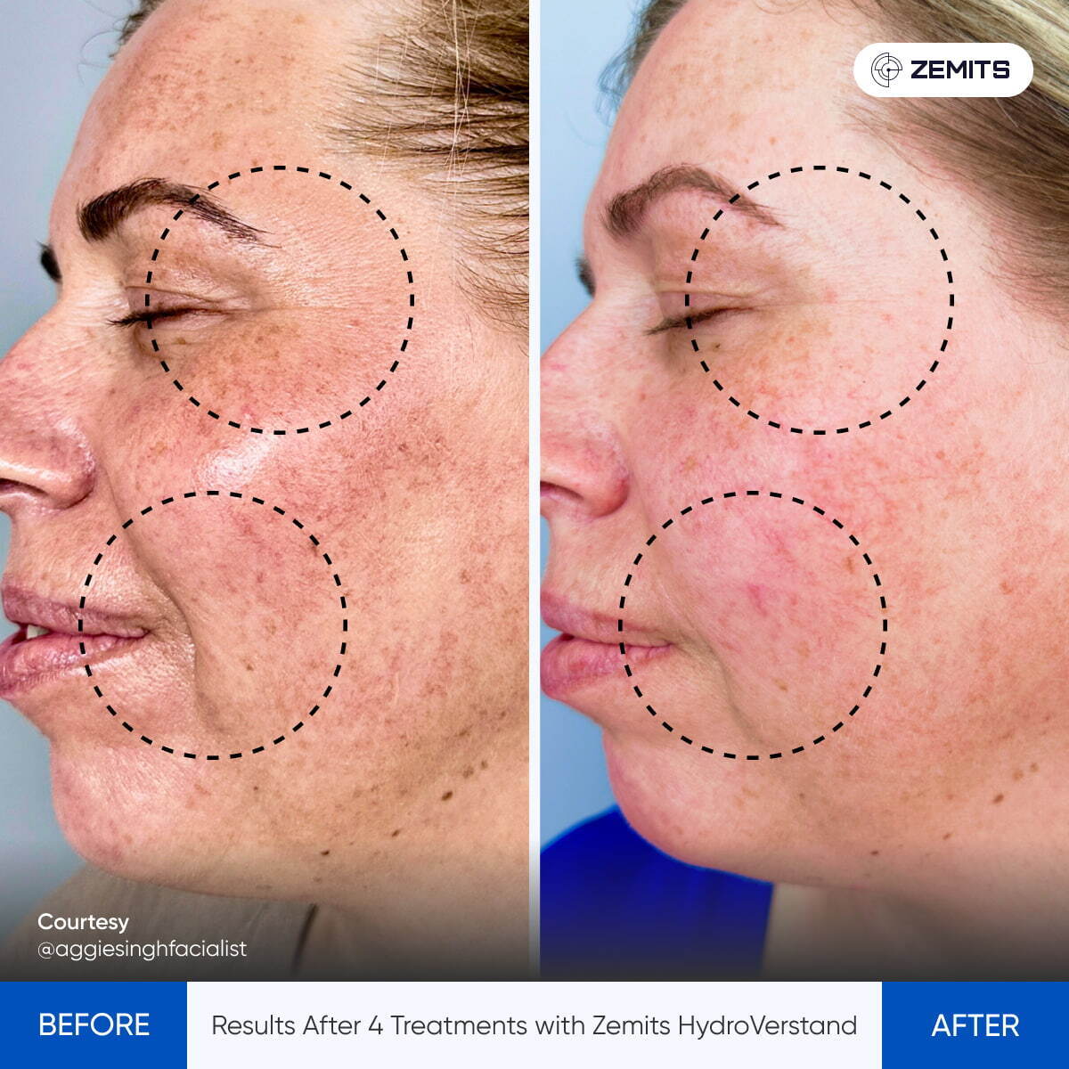 Before After Slide 5