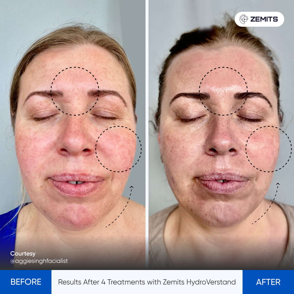 Before After Slide 1