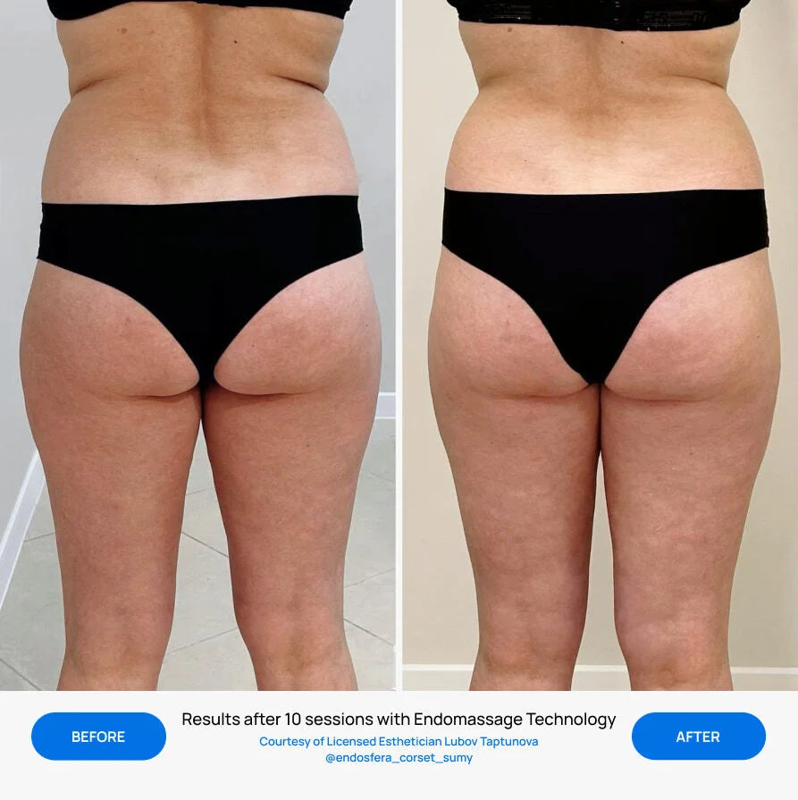 Before After Slide 2