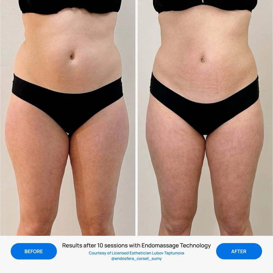 Before After Slide 4