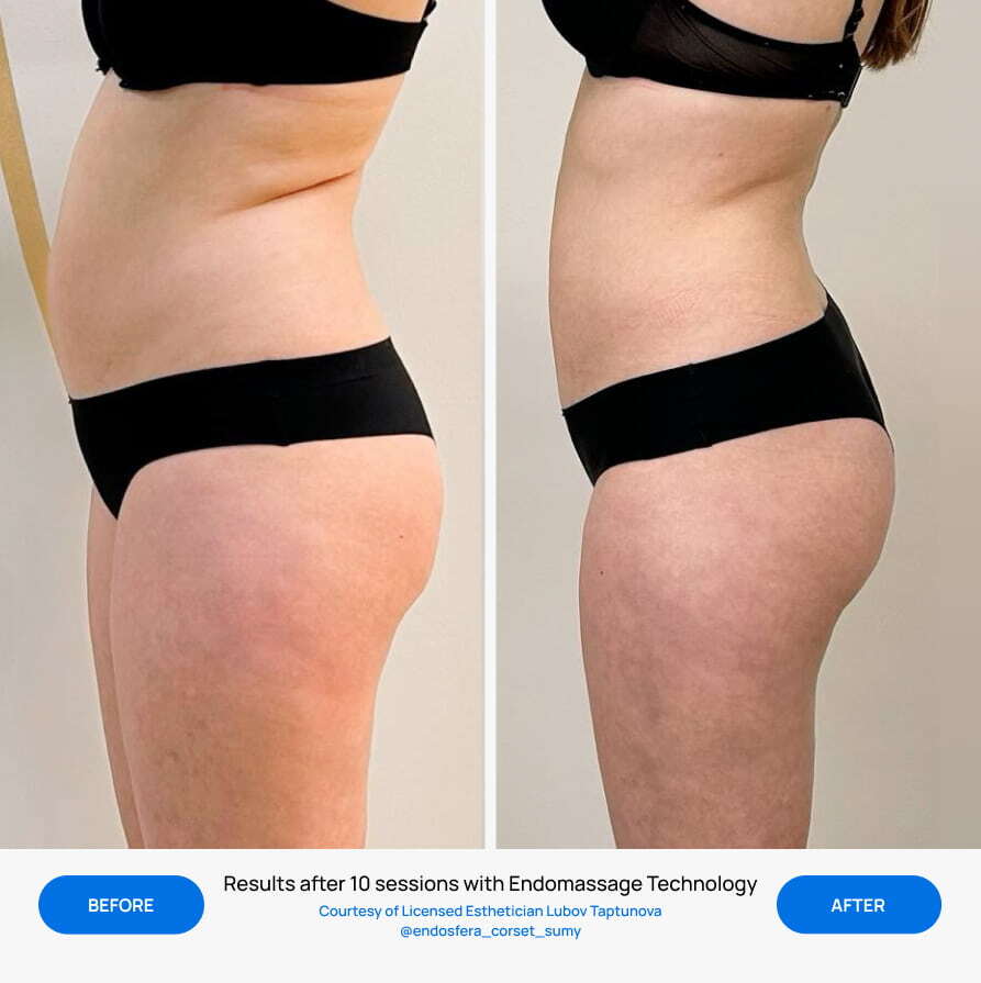 Before After Slide 5