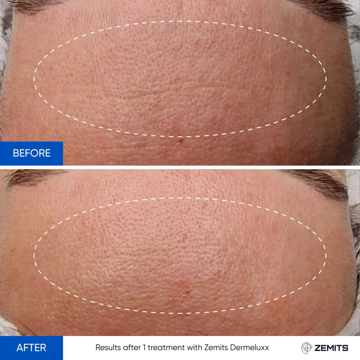 Before After Slide 5