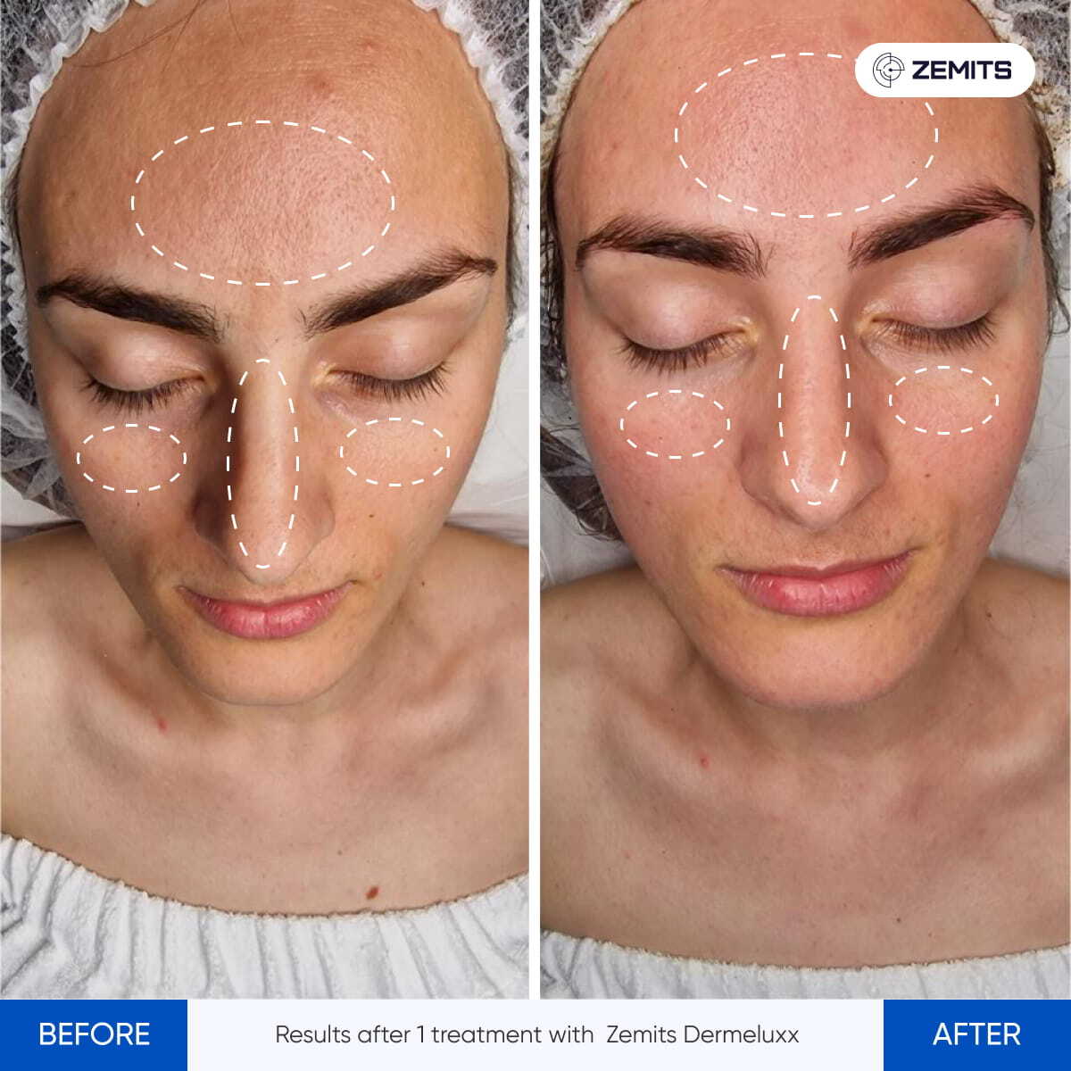 Before After Slide 6