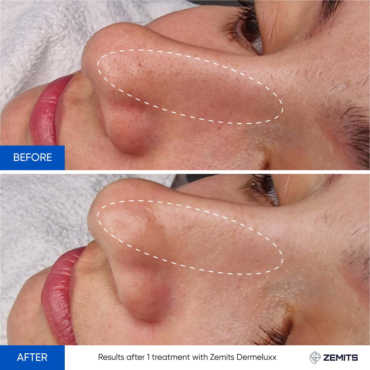 Before After Slide 7
