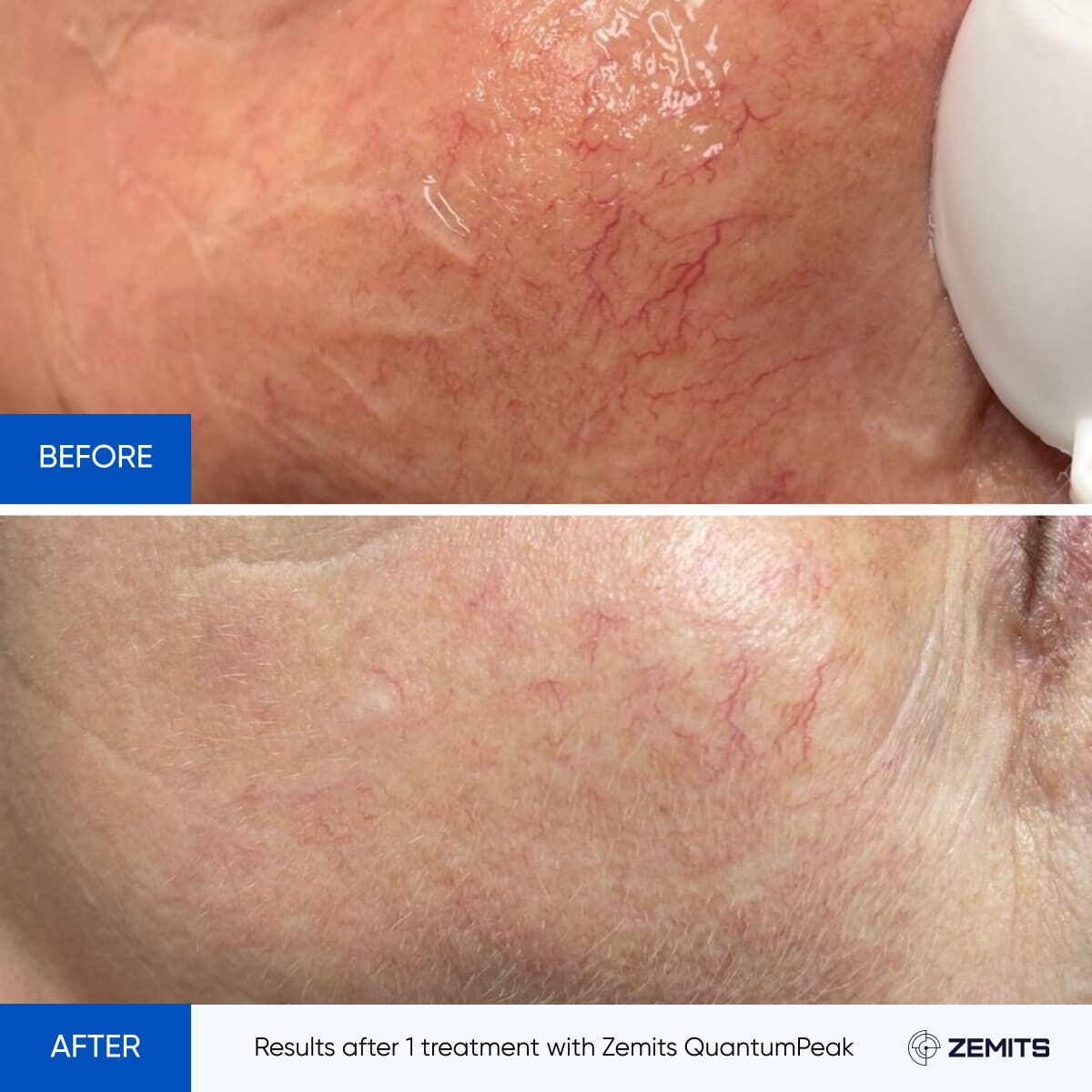 Before After Slide 3