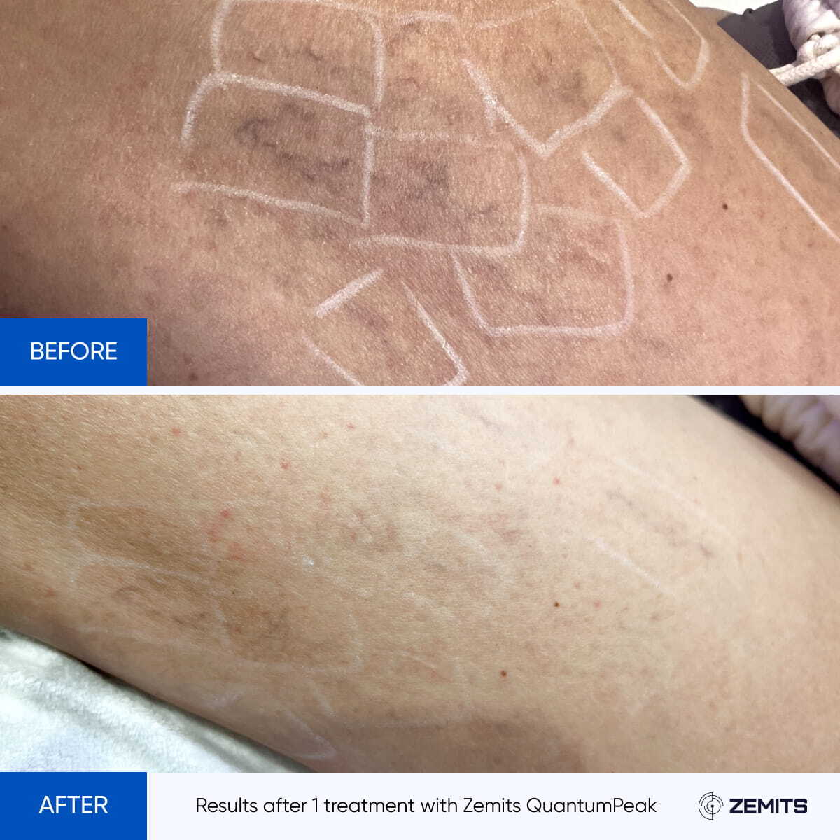 Before After Slide 5