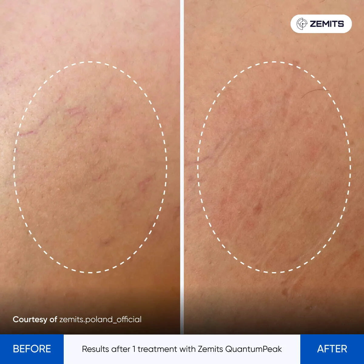 Before After Slide 6