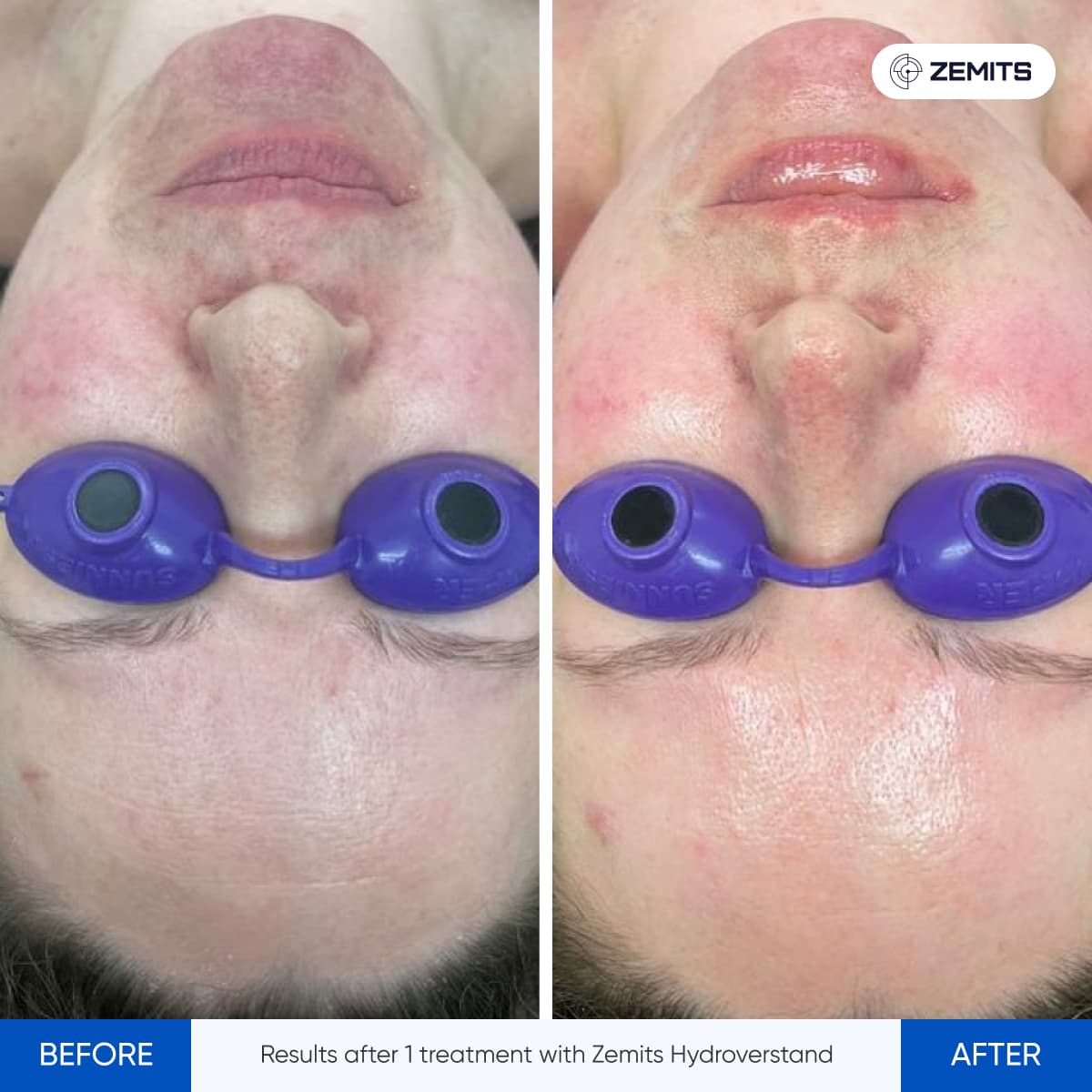 Before After Slide 7