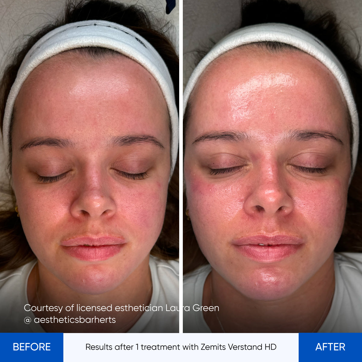 Before After Slide 1