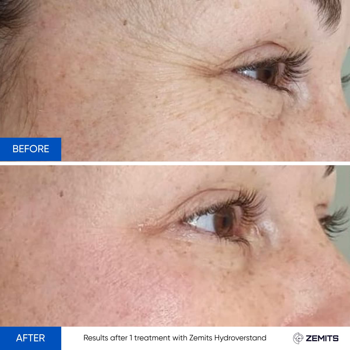 Before After Slide 8