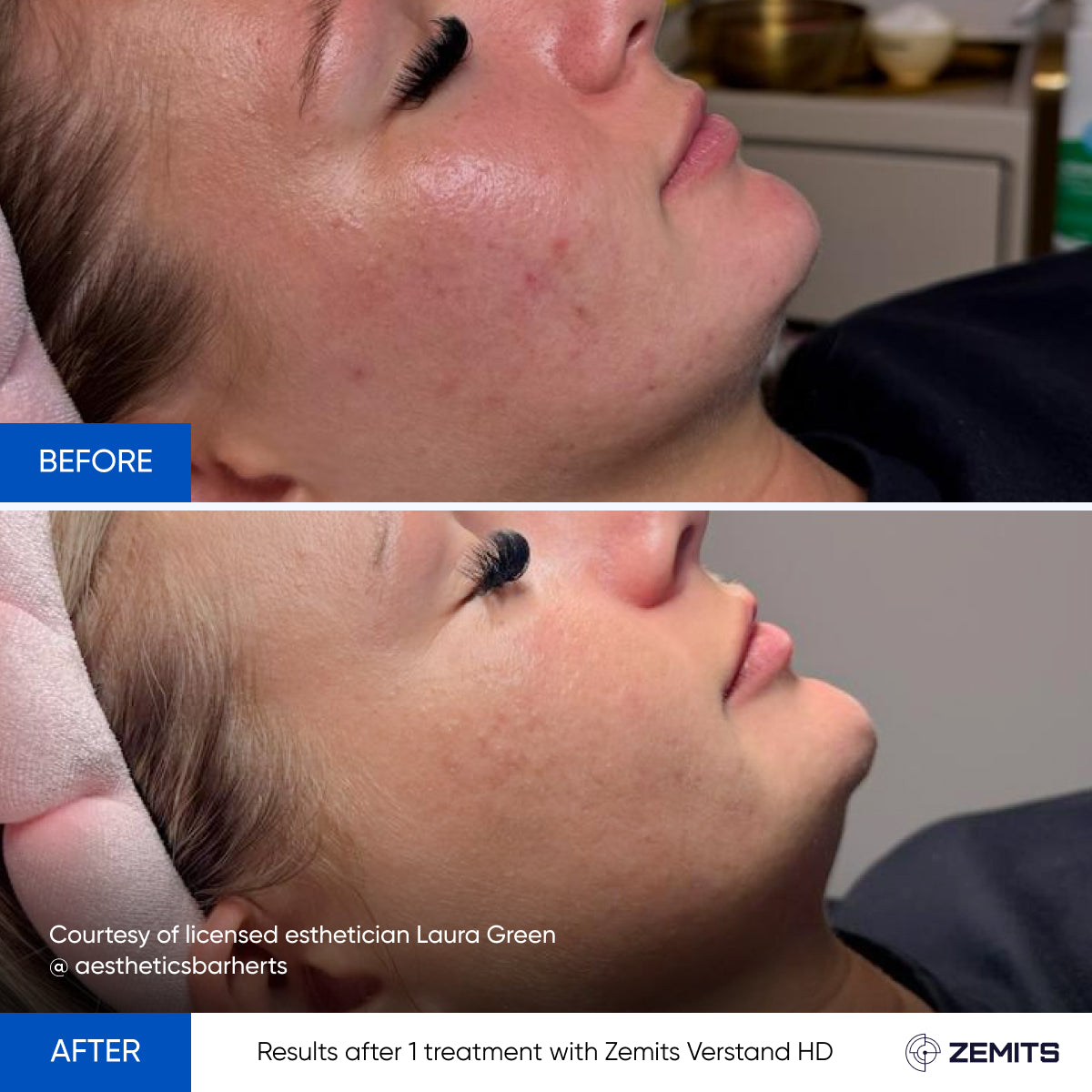 Before After Slide 2