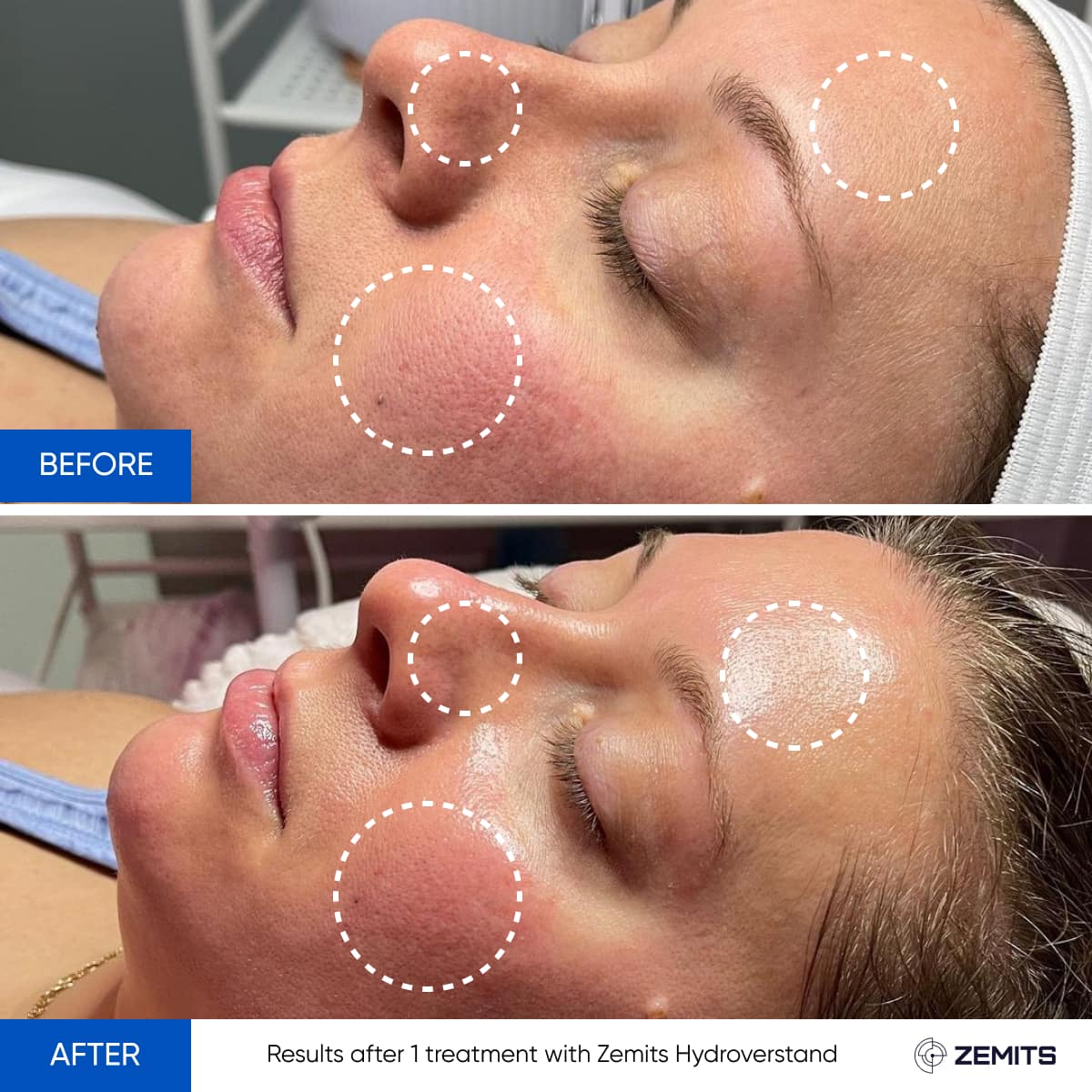 Before After Slide 9