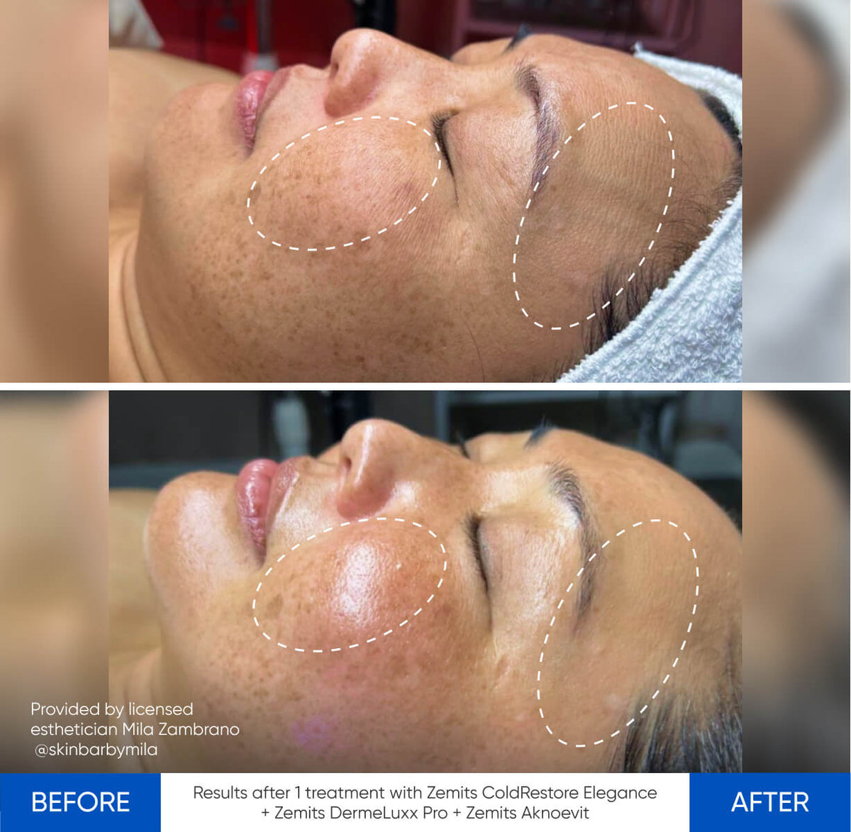 Before After Slide 3