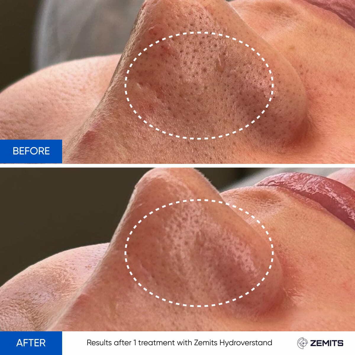 Before After Slide 10