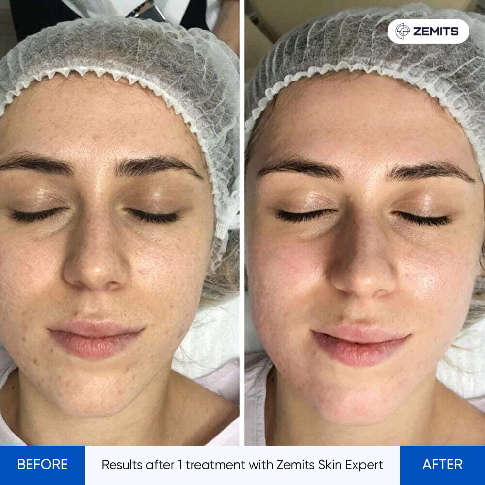 Before After Slide 2