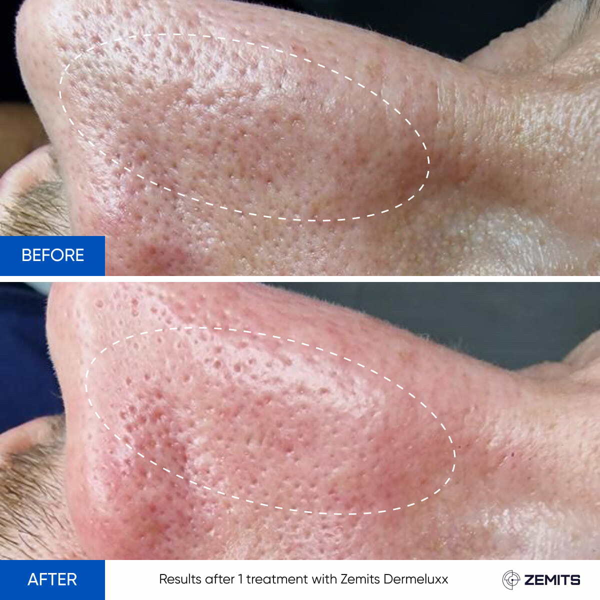 Before After Slide 23