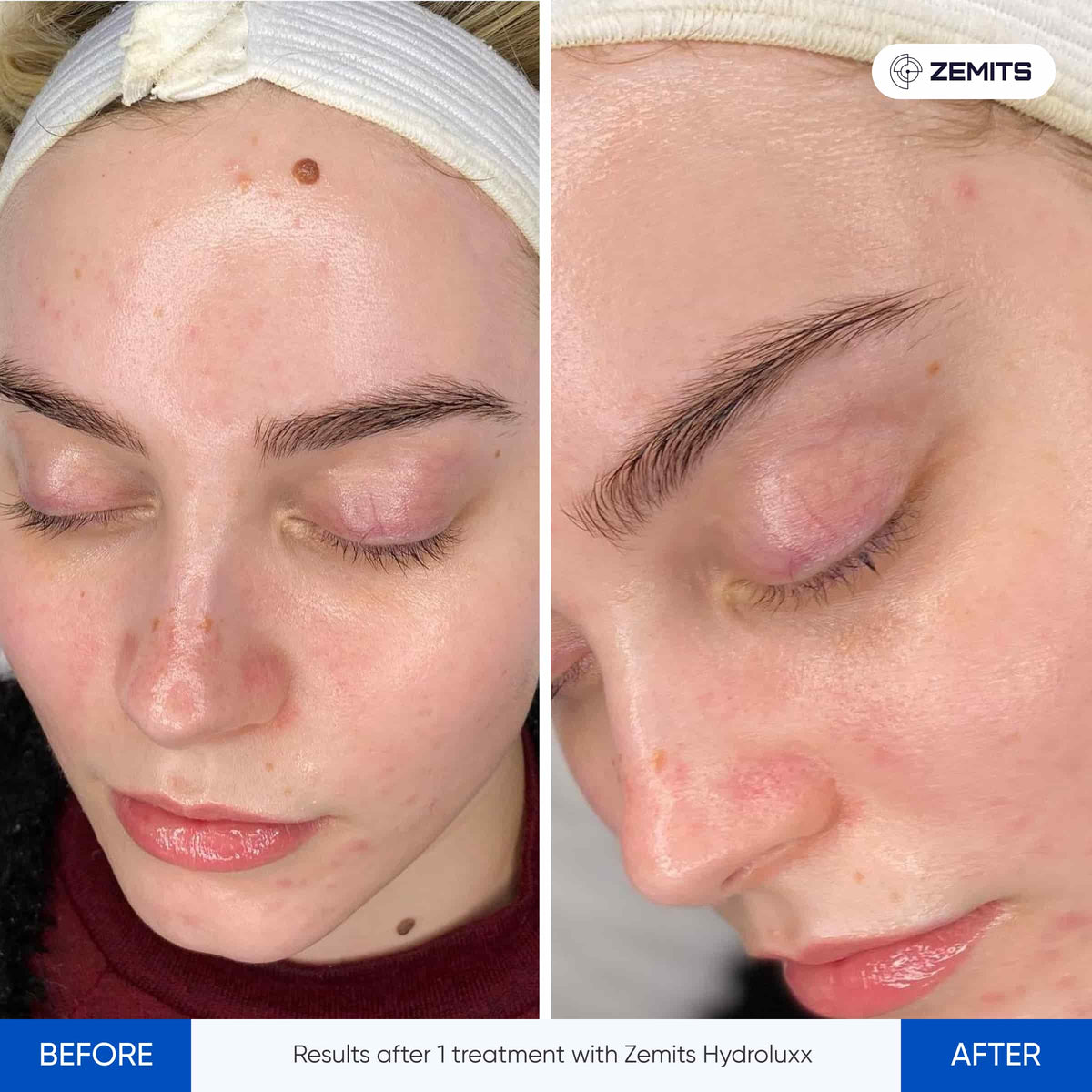 Before After Slide 1