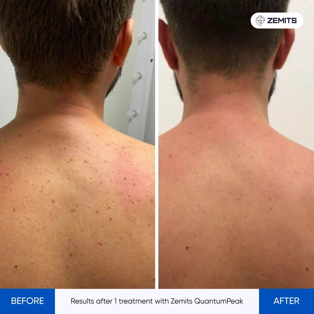 Before After Slide 1