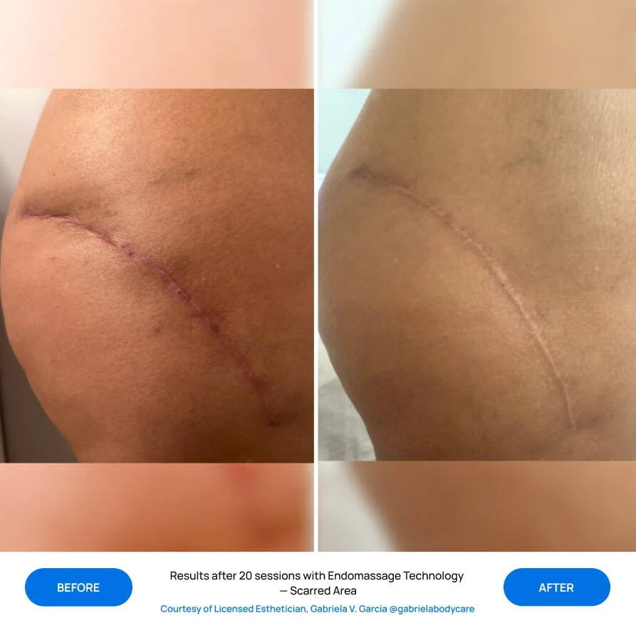 Before After Slide 2