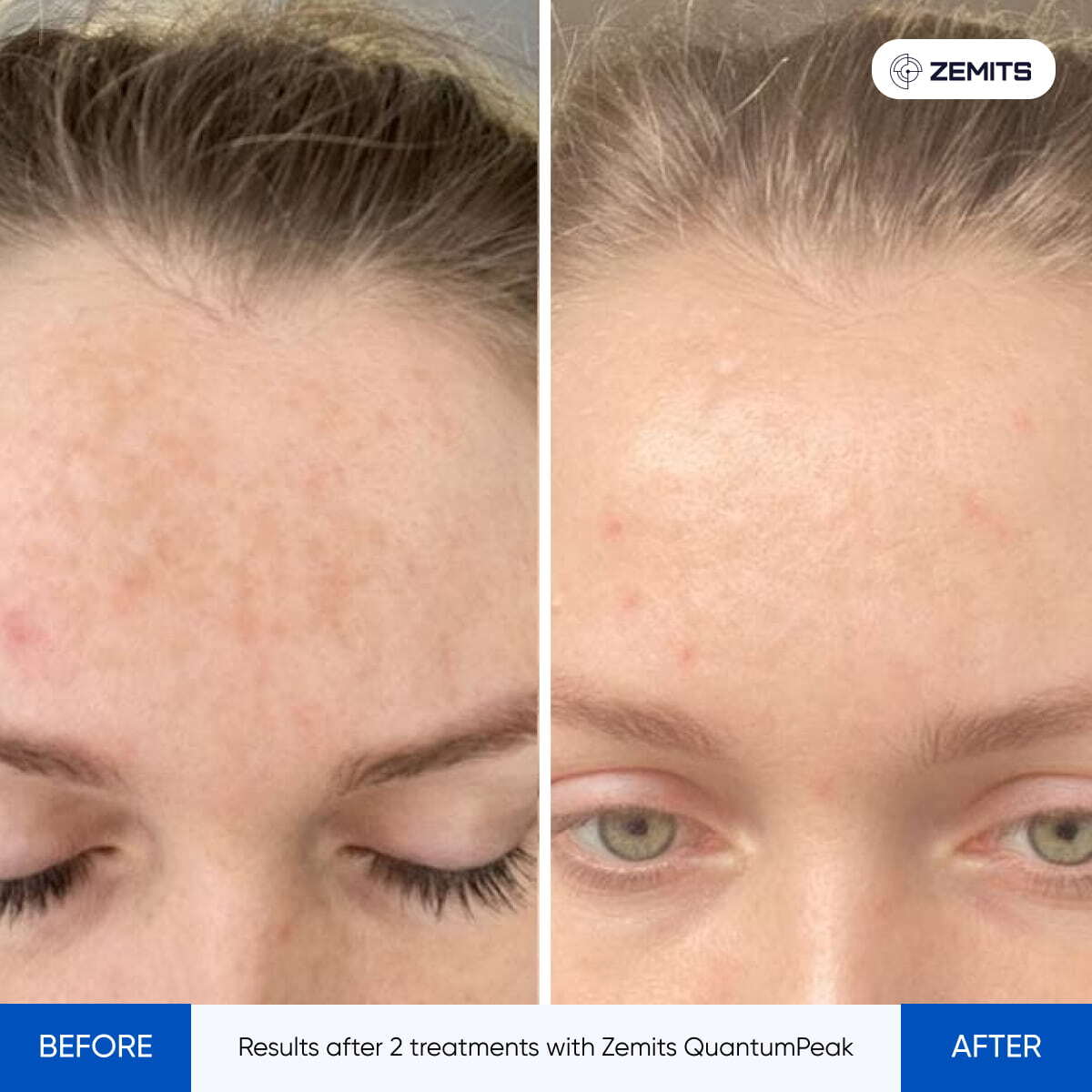 Before After Slide 8
