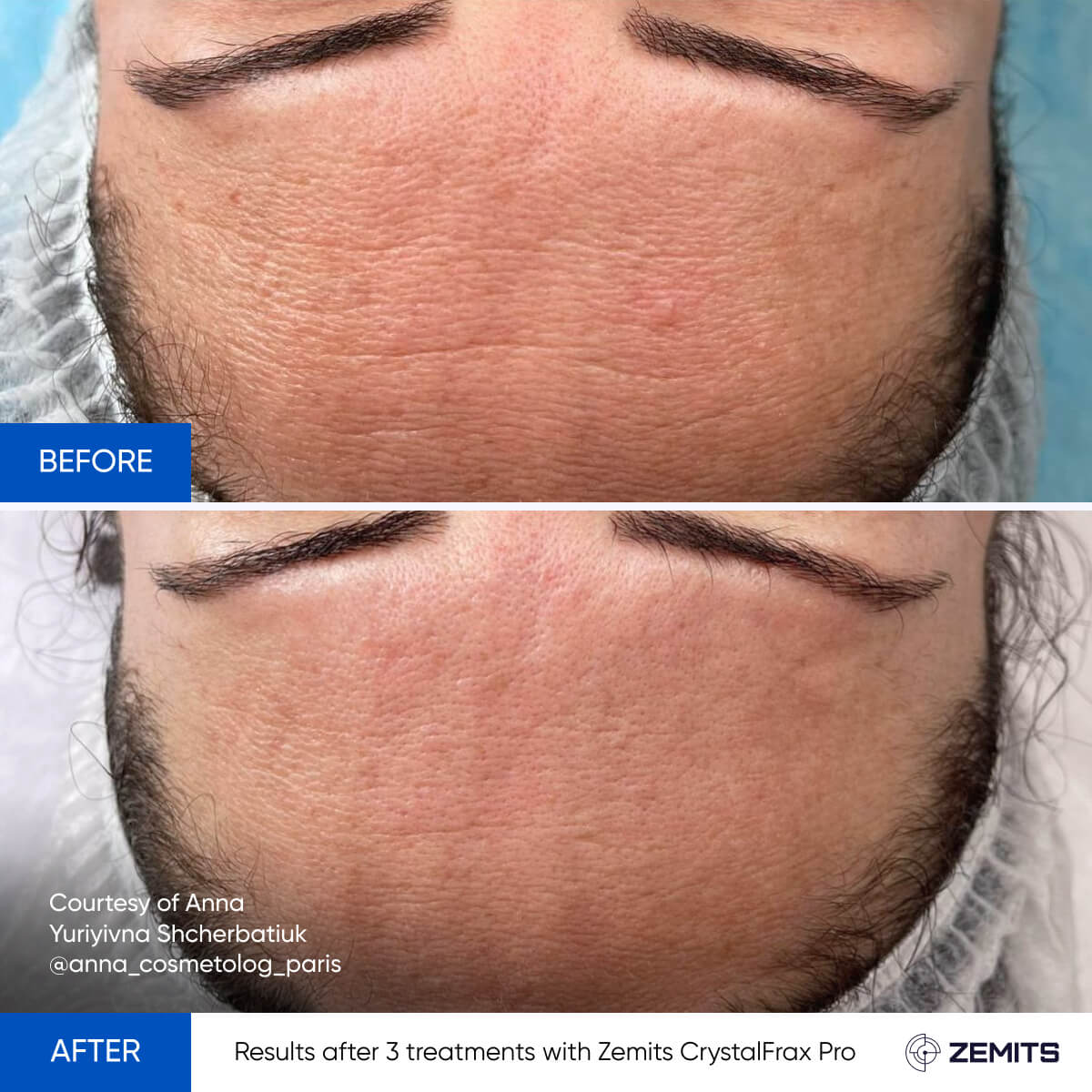 Before After Slide 4