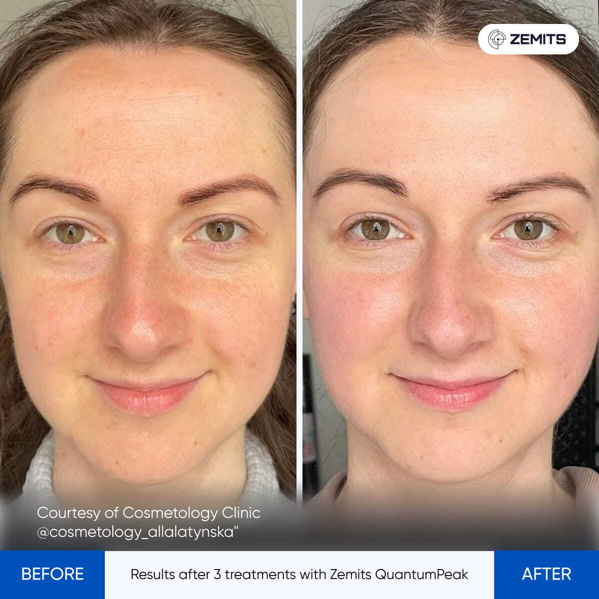 Before After Slide 9