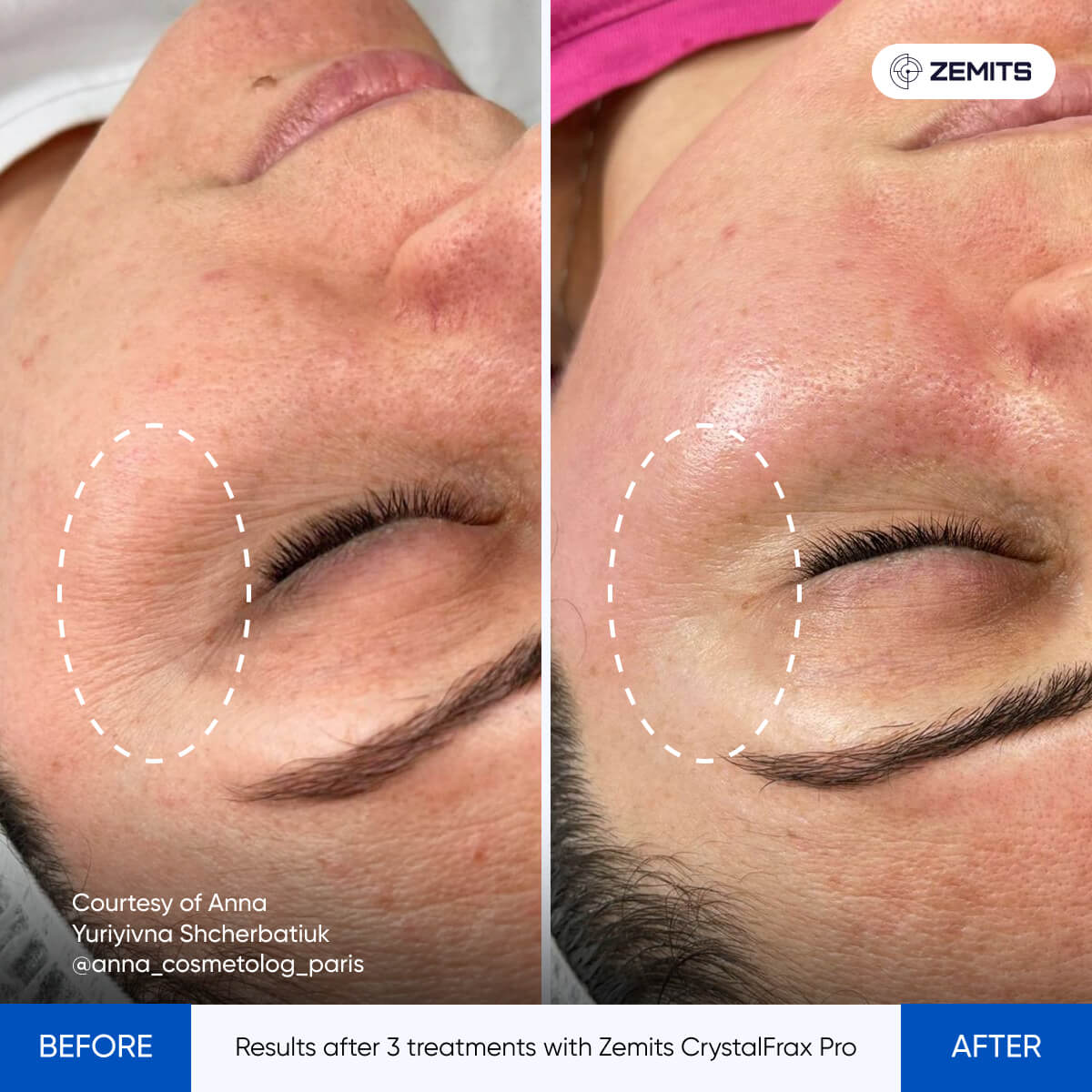 Before After Slide 8