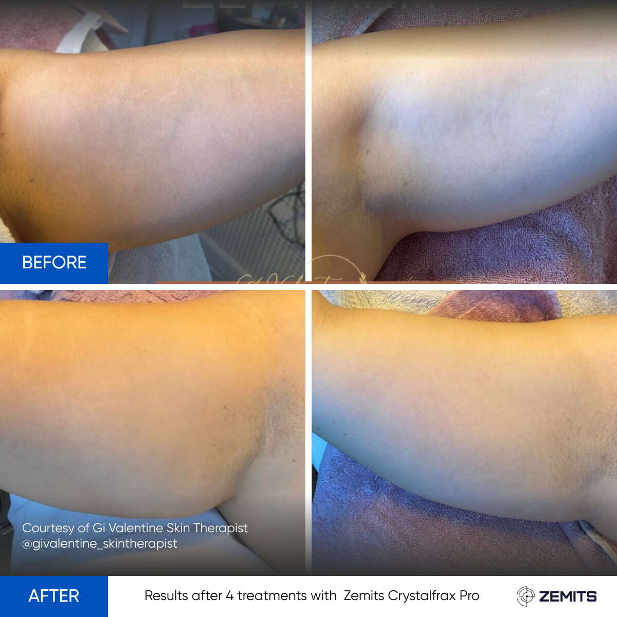 Before After Slide 3