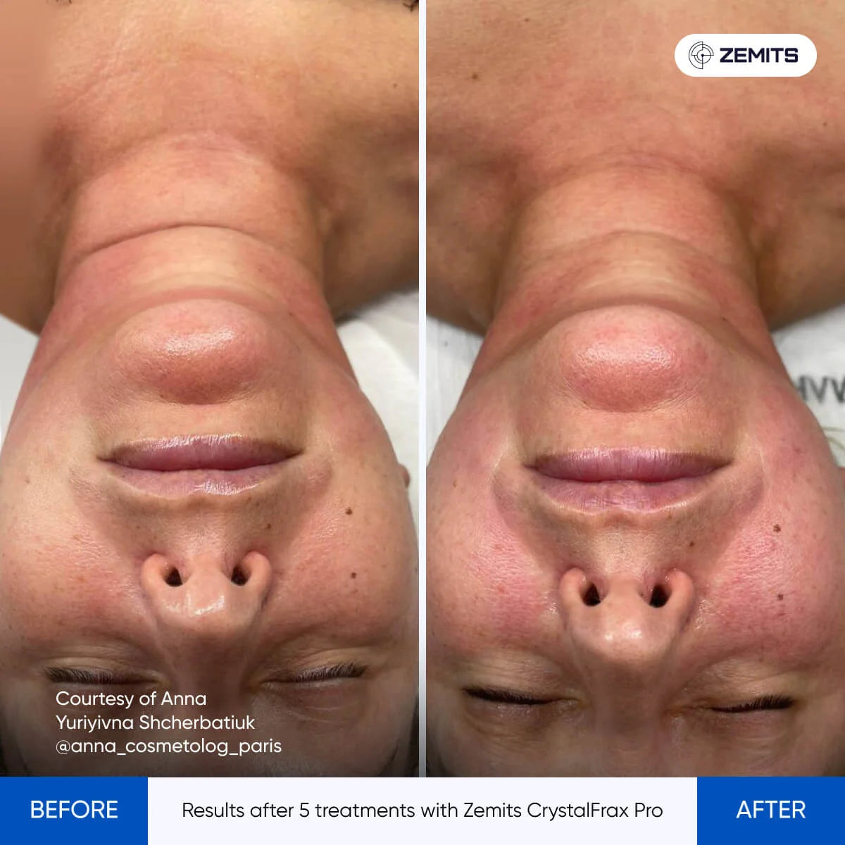 Before After Slide 2
