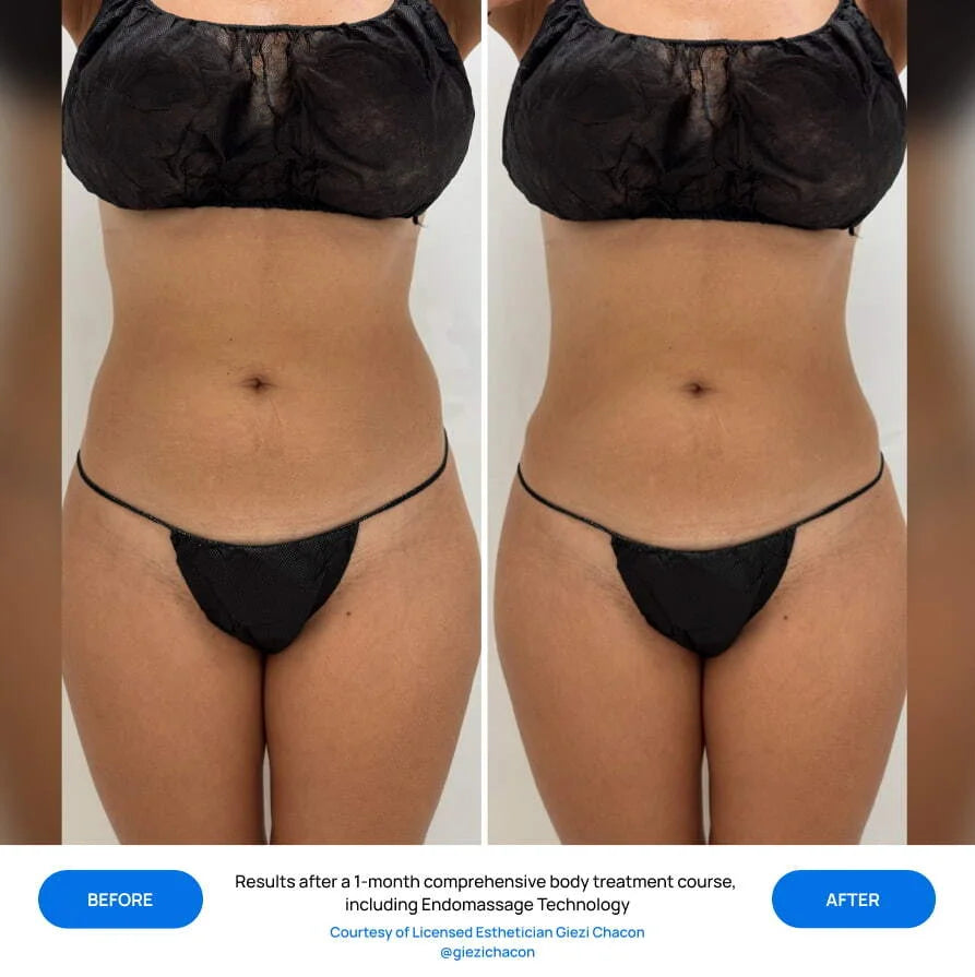 Before After Slide 3