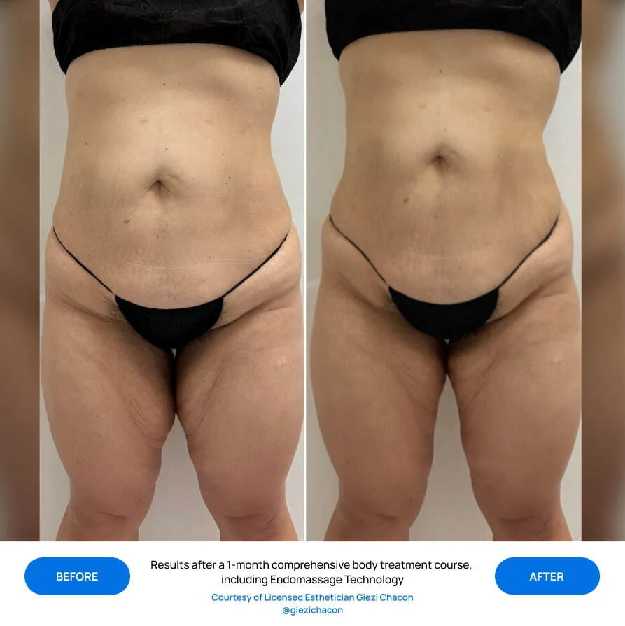 Before After Slide 2