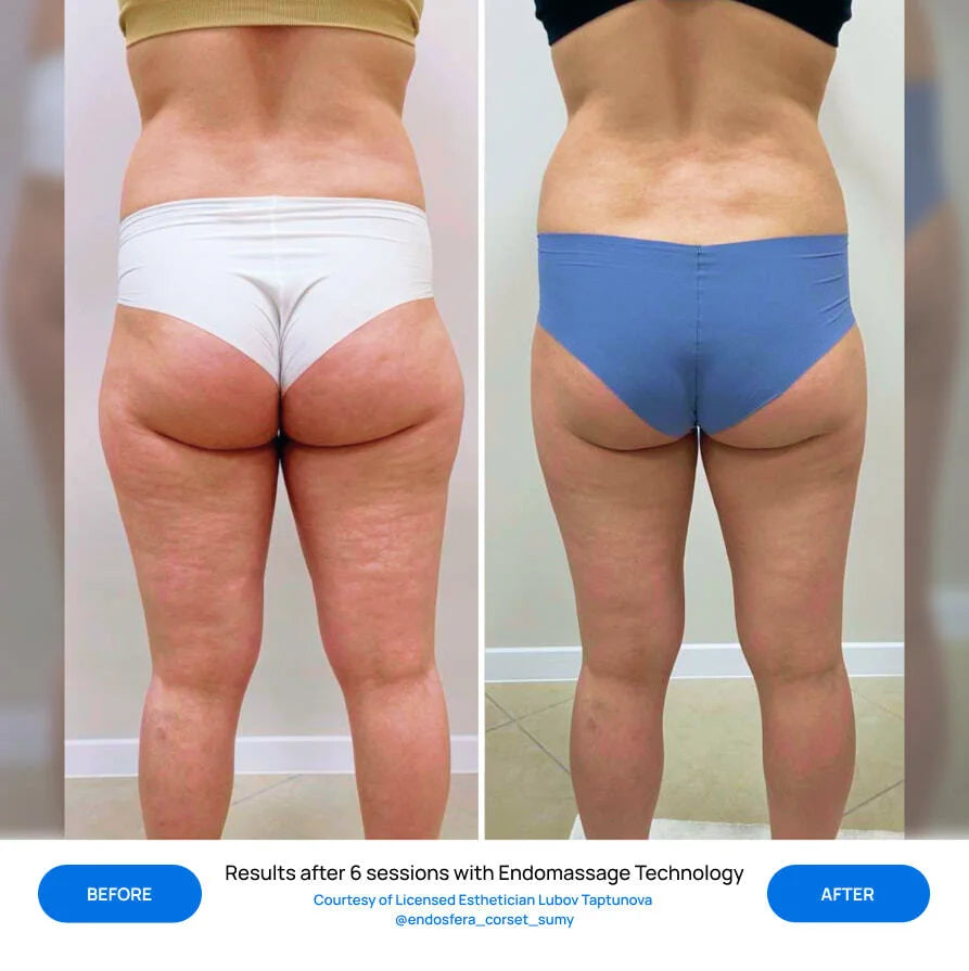 Before After Slide 7