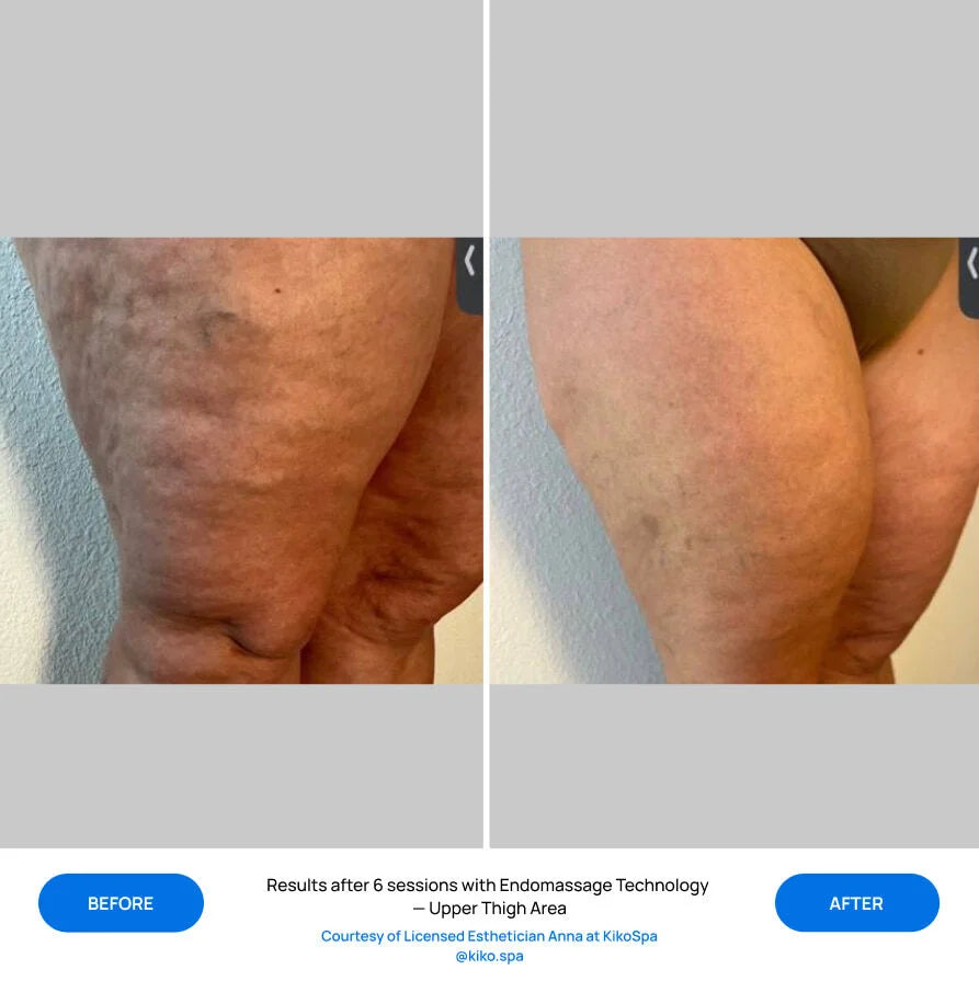 Before After Slide 1
