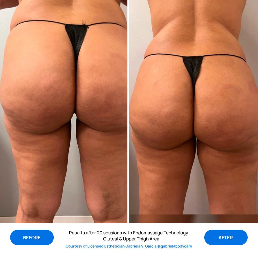 Before After Slide 5