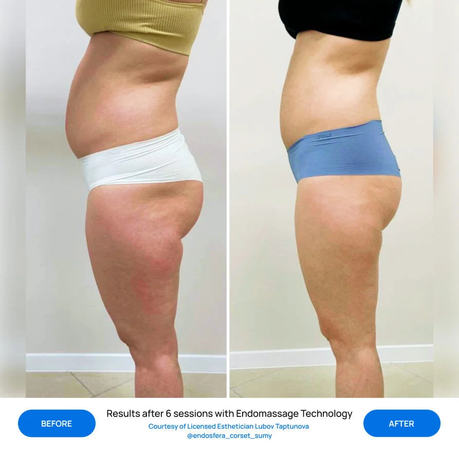 Before After Slide 8