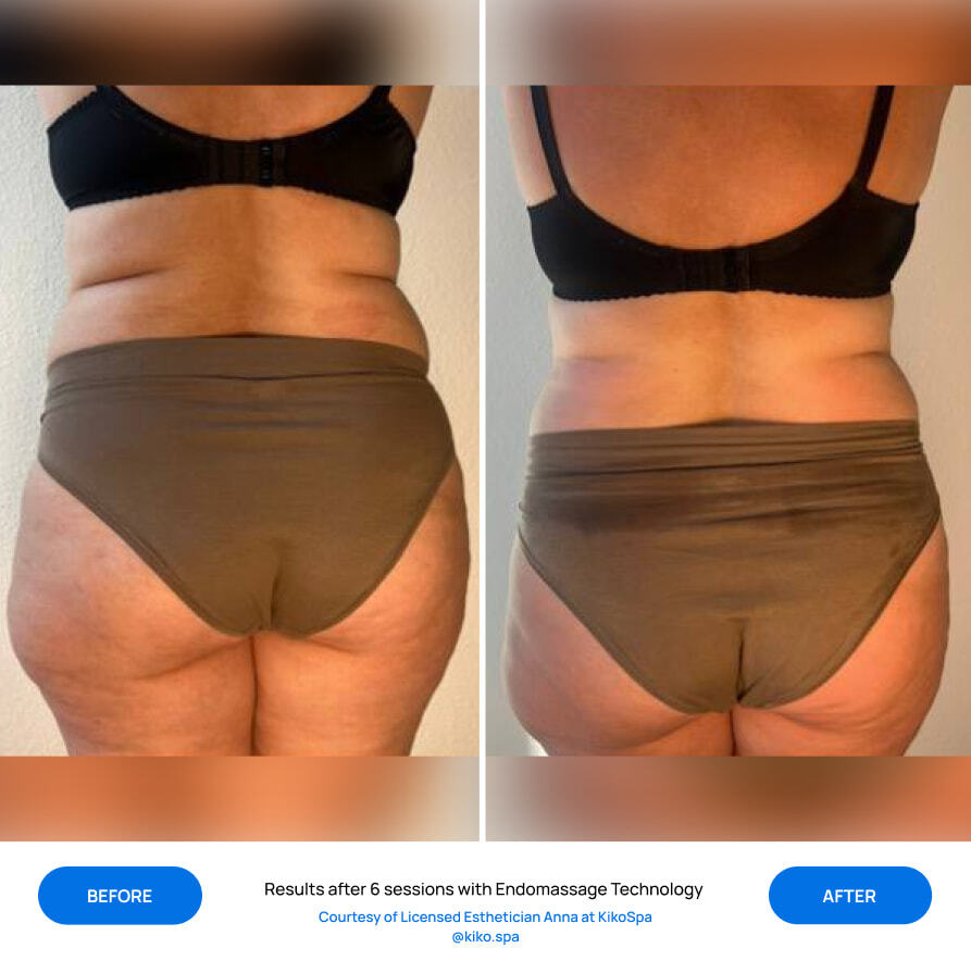 Before After Slide 4