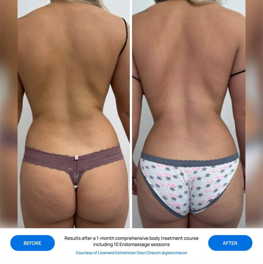 Before After Slide 9