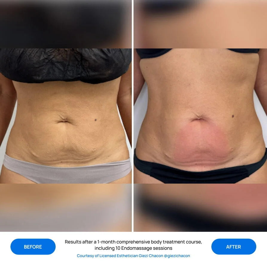 Before After Slide 1