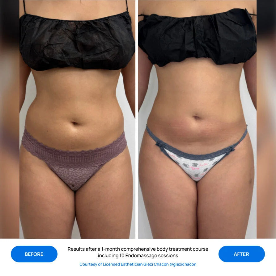 Before After Slide 1