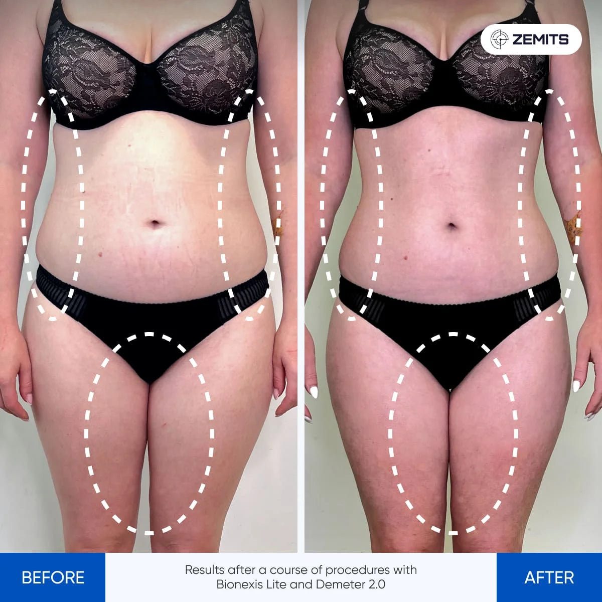 Before After Slide 2