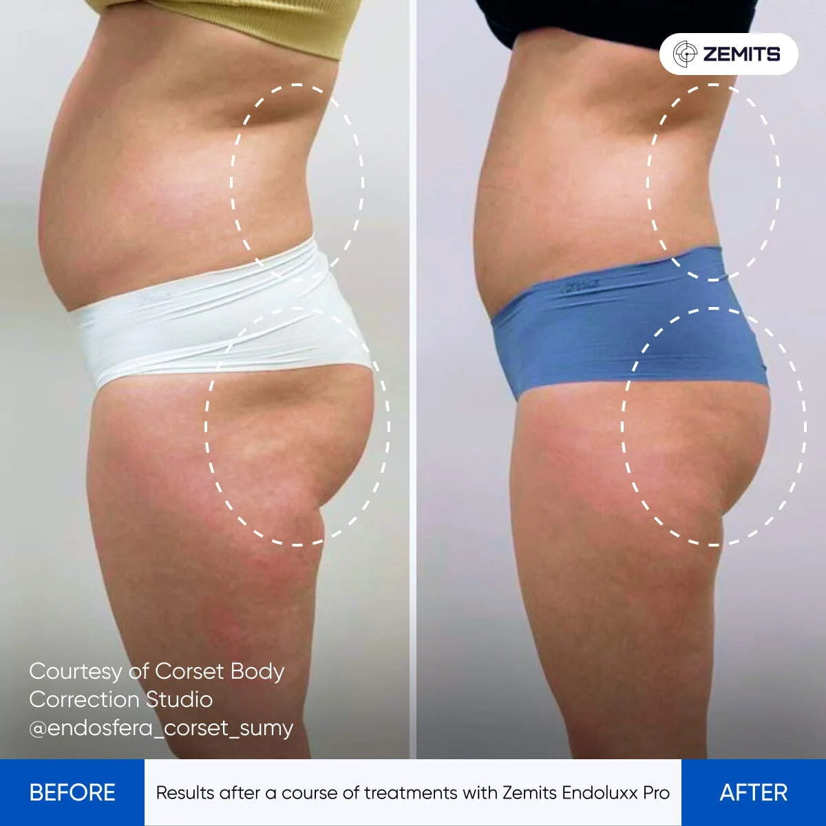 Before After Slide 2