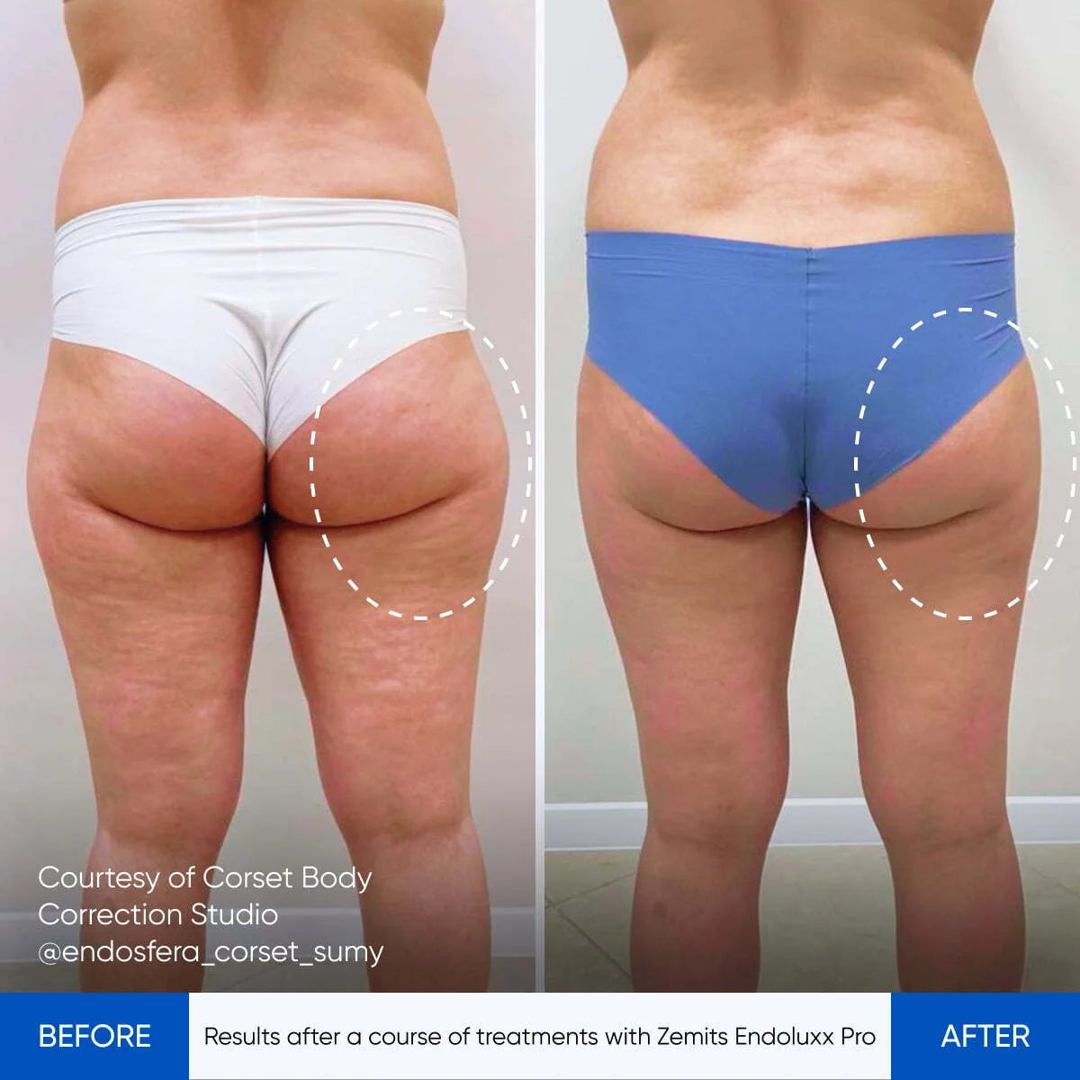 Before After Slide 3