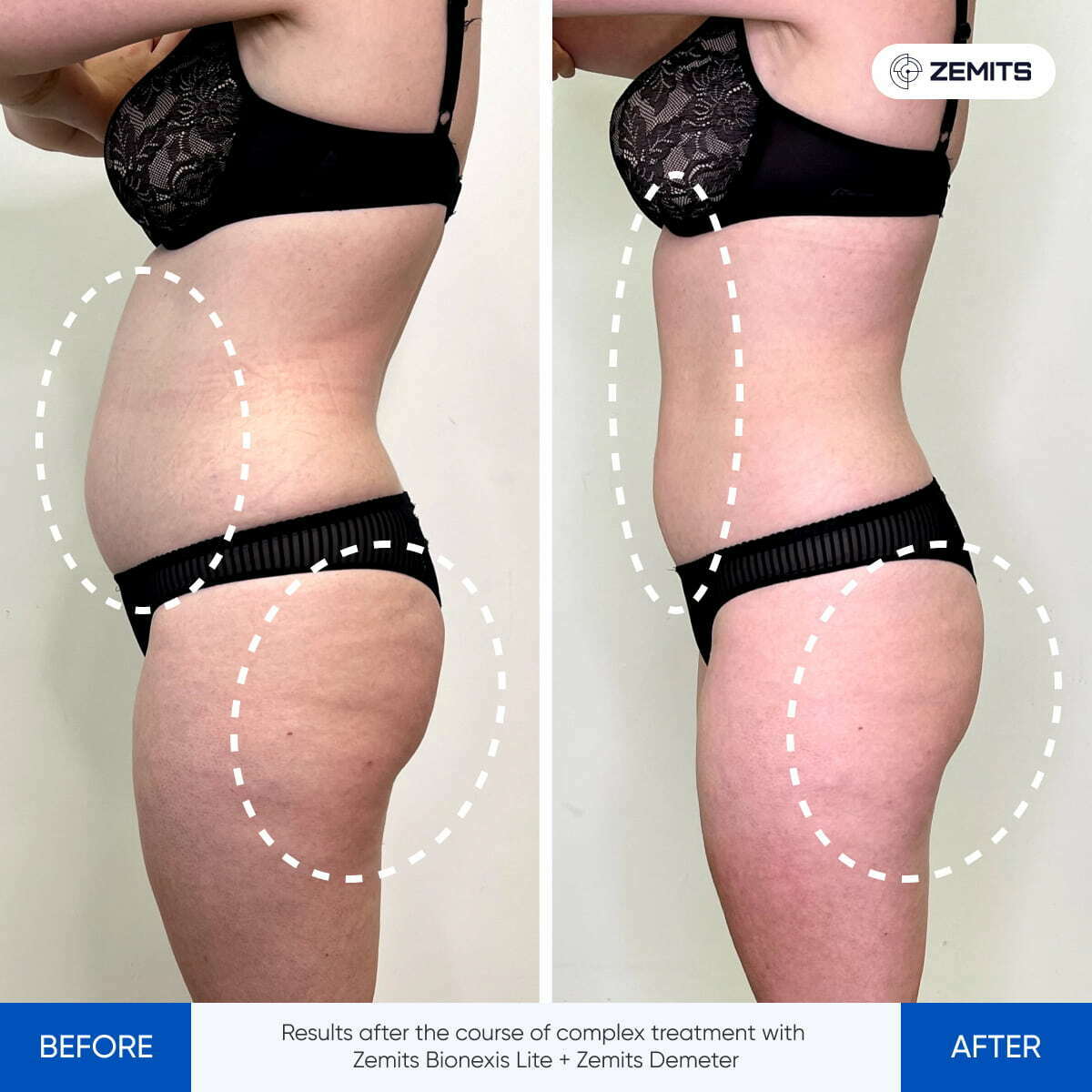 Before After Slide 2