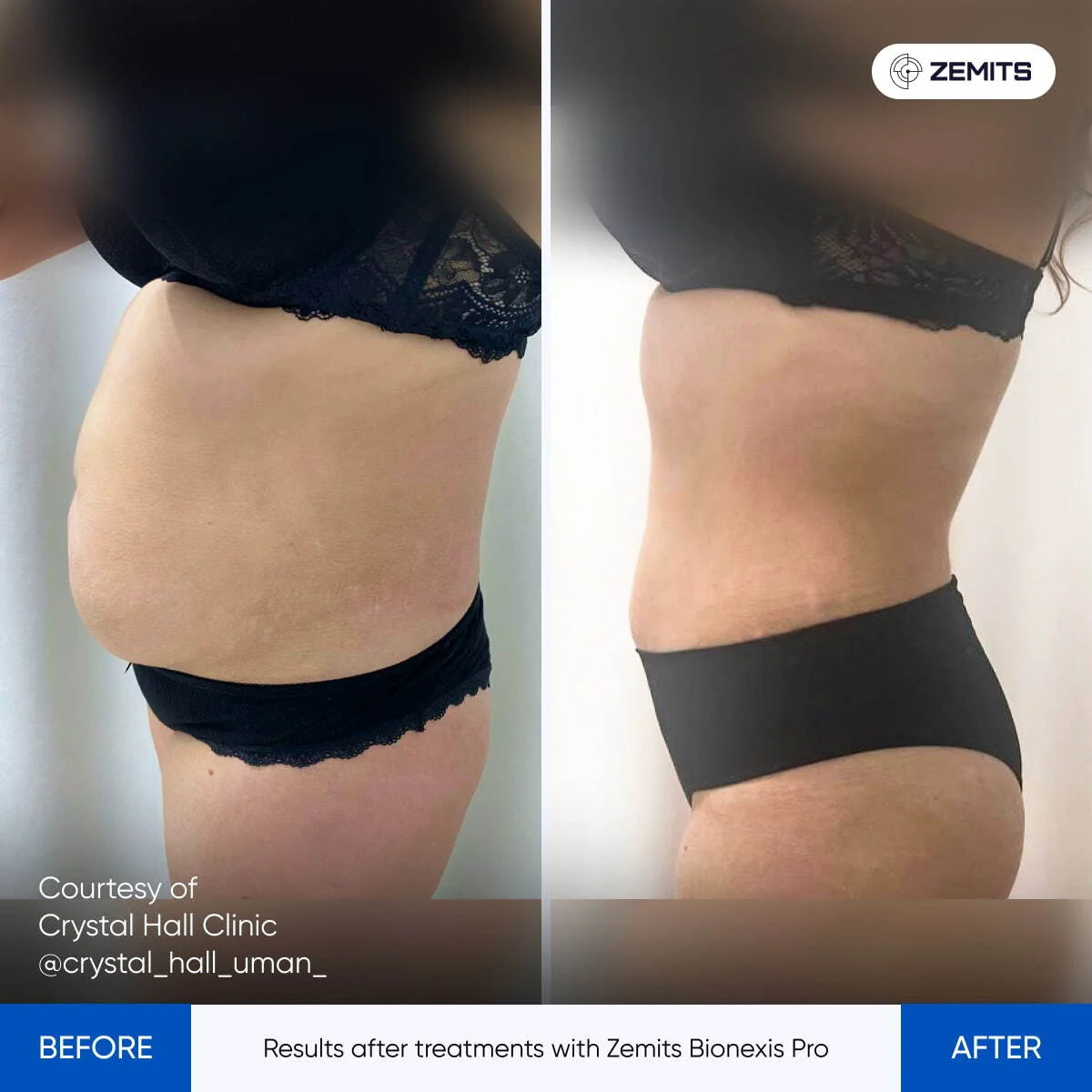 Before After Slide 2