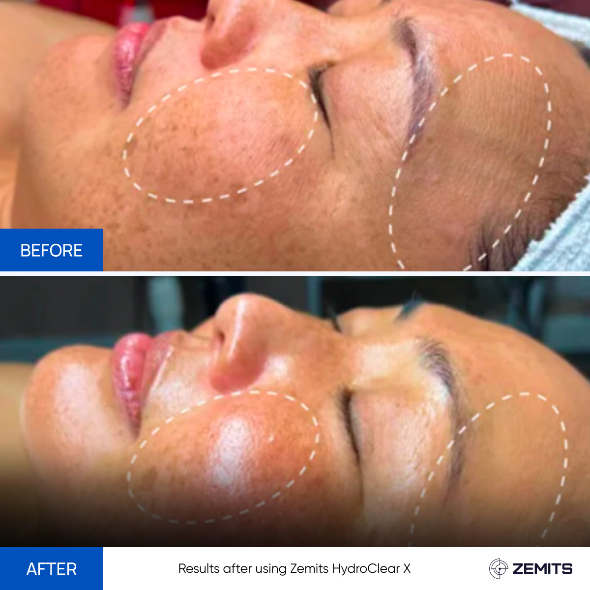 Before After Slide 2