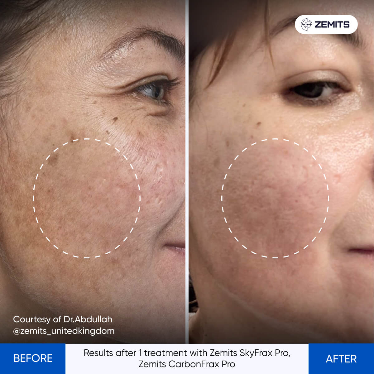 Before After Slide 4